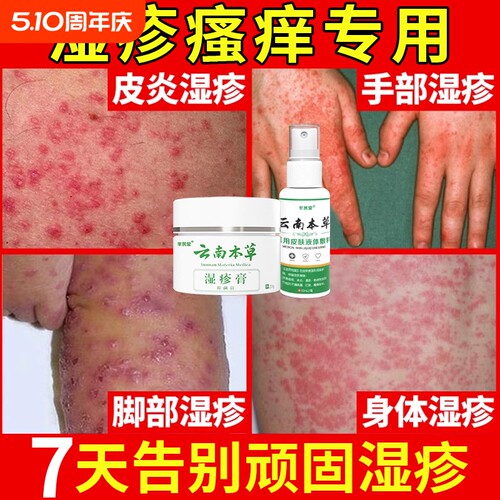云南本草去顽固湿疹专用套装