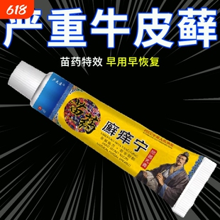 苗家止痒抑菌膏顽固牛皮藓头皮手足皮肤体股藓痒身上瘙痒外用水泡