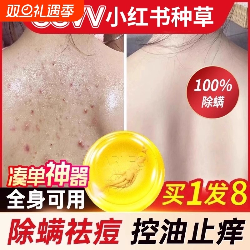 苦参除螨皂硫磺香皂男祛痘人参去螨虫手工皂洗脸皂洗澡沐浴背部女