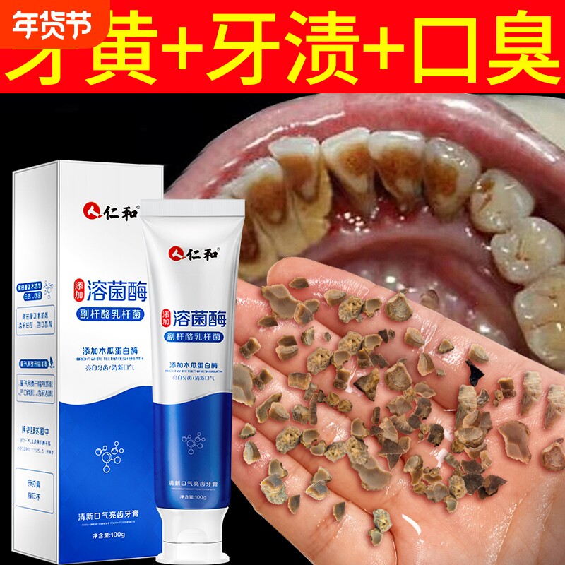 仁和牙膏美白去黄口臭渍成人洗亮白神器官方正品专用牙齿牙结石