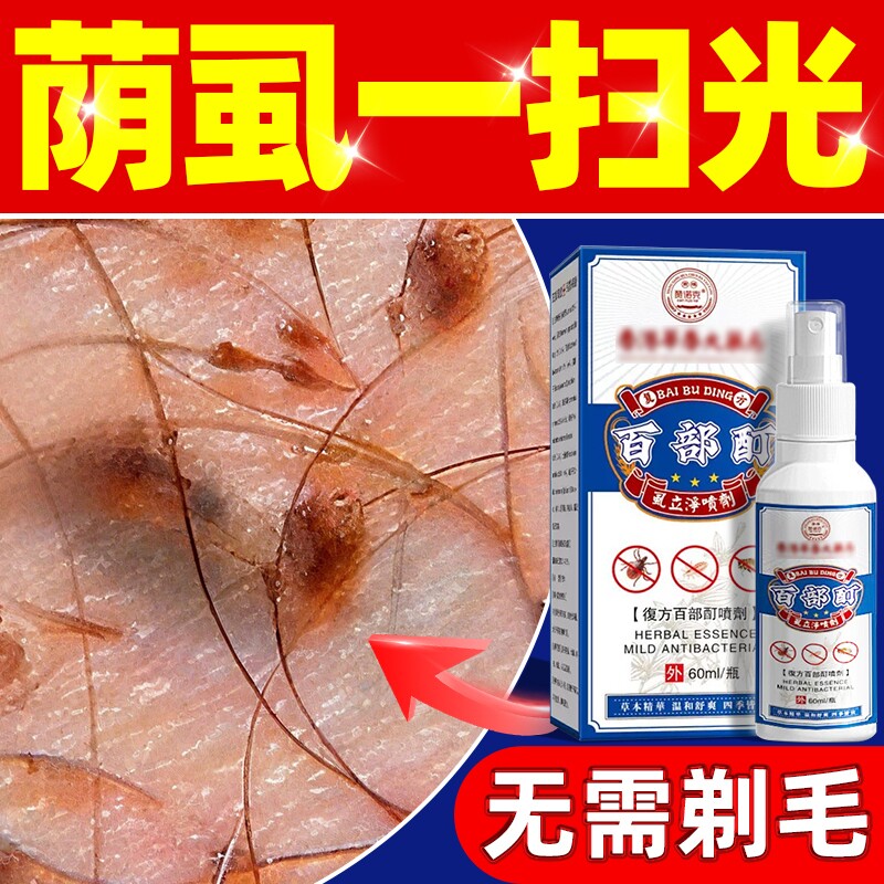 百部酊灭阴虱专用喷剂药头虱立净喷剂男女士私处虱子成人正品