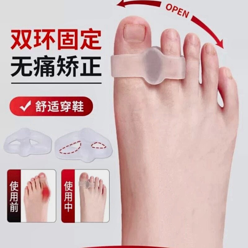 脚趾矫正器拇指外翻大母脚指分趾器软硅胶可以穿鞋分离大脚骨神器