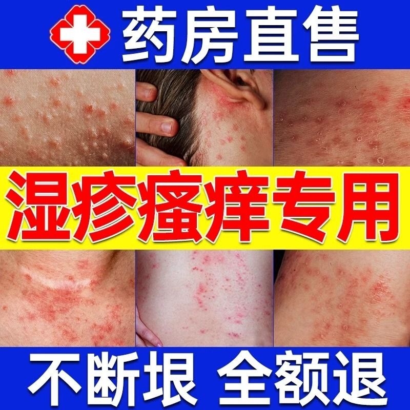 顽固湿疹膏止痒去皮肤外用根阴囊潮湿瘙痒私处睾丸痒皮炎水泡抑菌 医疗器械 保健理疗 原图主图