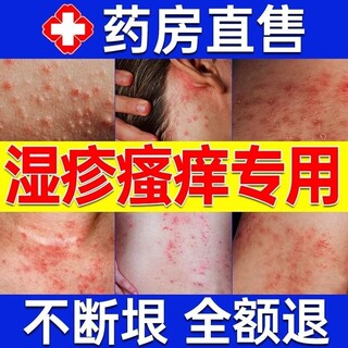 顽固湿疹膏止痒去皮肤外用根阴囊潮湿瘙痒私处睾丸痒皮炎水泡妇科