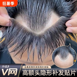假发片男士隐形前额假刘海全真发一片式生物头皮m型发际线假发贴