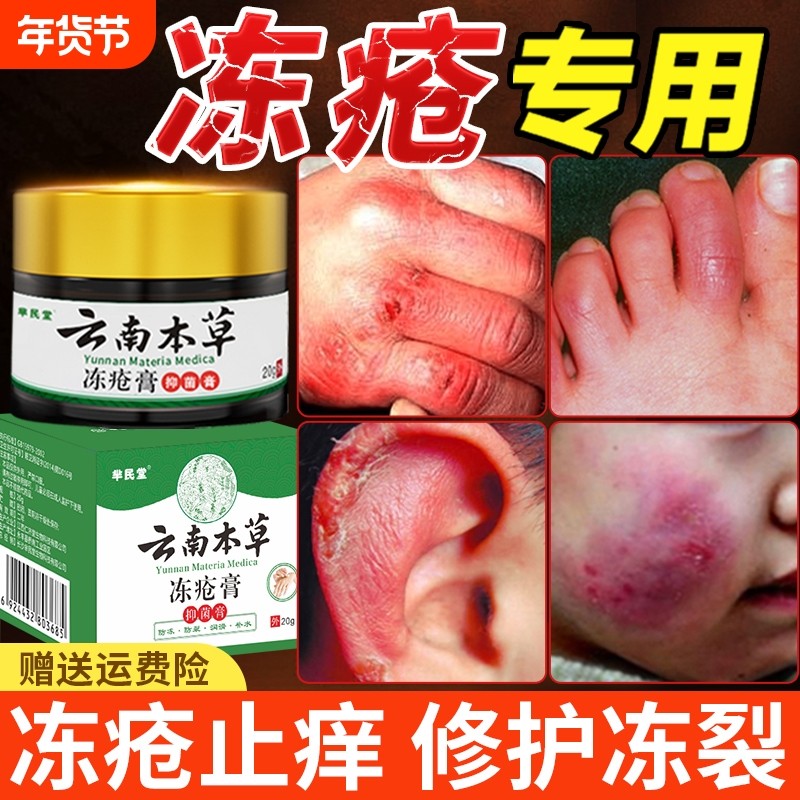 冻疮膏止痒冻伤膏防裂冻正品耳朵脸部消肿儿童冻手神器防冻霜抑菌,保健用品,皮肤消毒护理（消）,淘宝优惠券,粉丝福利购,淘宝优惠卷