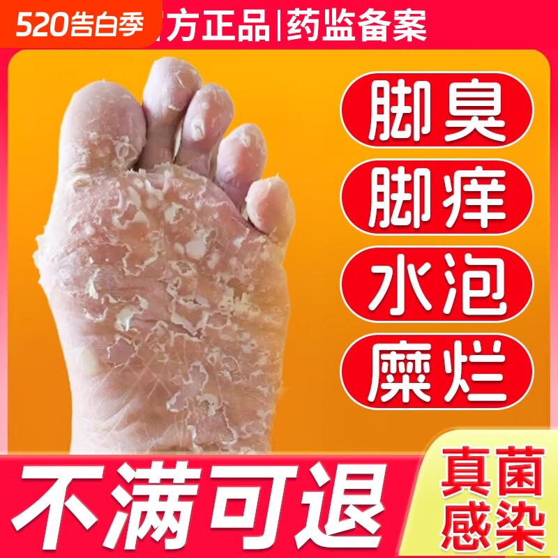 脚气喷雾止脱皮痒杀菌真菌感染专用臭脚痒出汗脚泡脚根趾缝糜烂痒