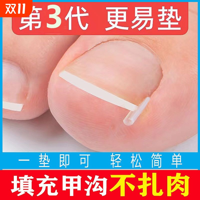 甲沟炎矫正神器指甲嵌甲专用隔离填充垫片脚趾甲往肉纠正甲贴手指