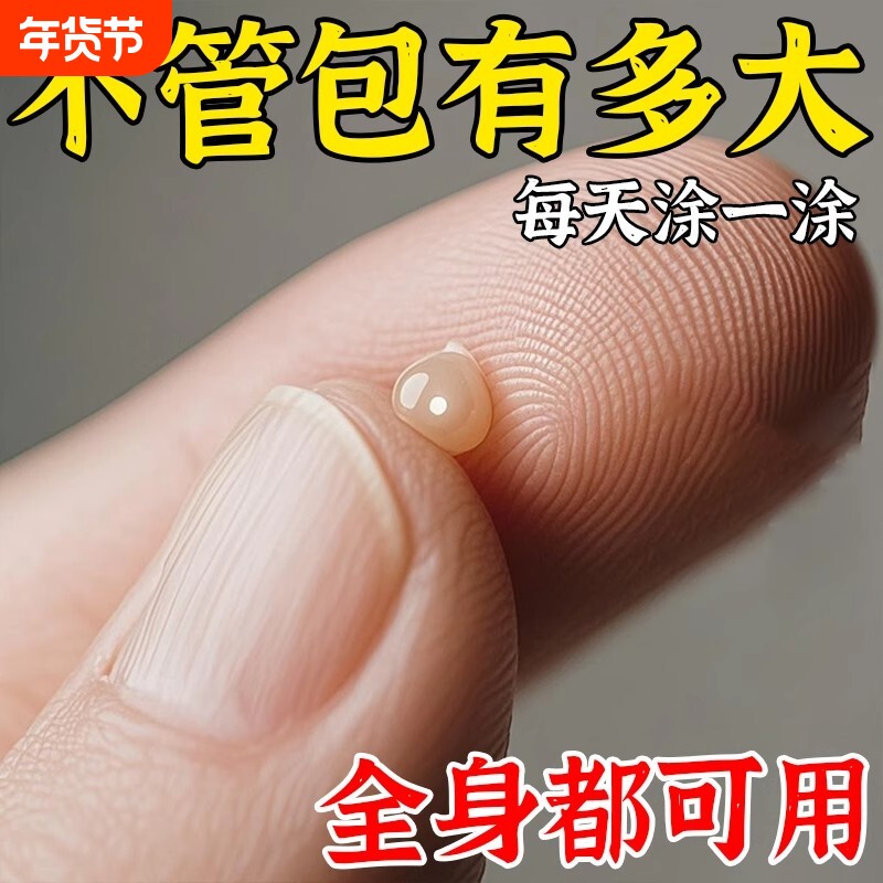 香港脂肪康脂肪瘤皮下鼓包硬块凸起肿块草本手脚全身正品涂抹霜