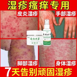 濕疹止癢去外用根肛門陰囊潮濕瘙癢私處睪丸癢皮膚肛周藥膏男人