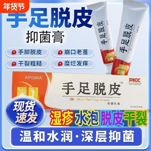 正品手脚脱皮膏手足干裂手痒皮肤干燥水泡止痒粗糙防裂超滋润