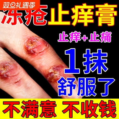 冻疮膏消肿止痒冻伤膏儿童专用耳朵脸部手足干裂防冻裂修复霜S