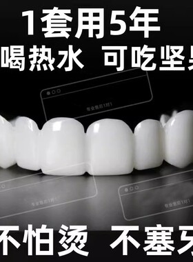 日本品质仿真牙套吃饭神器遮丑