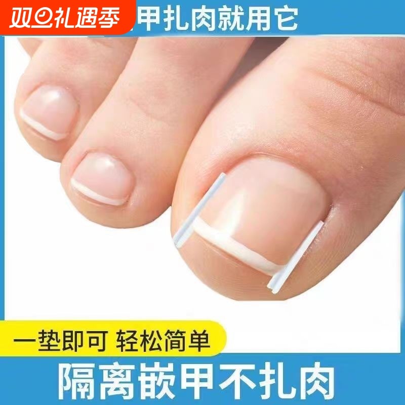 甲沟垫矫正器专用|超4600人收藏