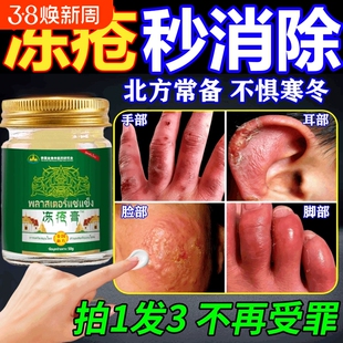 冻疮膏足耳朵干裂止痒修复膏护防冻皲裂医用冻伤膏消肿活血脸部