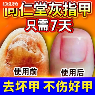 灰指甲专用阿莫同仁堂旗舰店修复脱甲膏罗芬真菌感染抑菌液搽剂