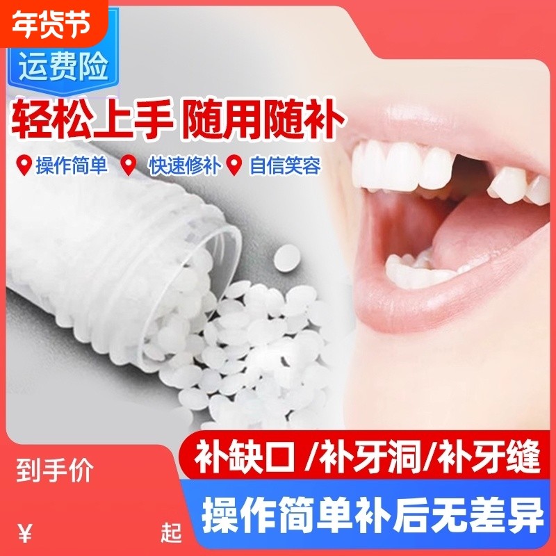 树脂材料牙齿自己洞假牙套补永久牙神器填充膏在家牙缝正品临时