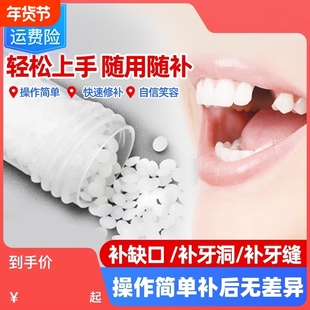 树脂材料牙齿自己洞假牙套补永久牙神器填充膏在家牙缝正品临时