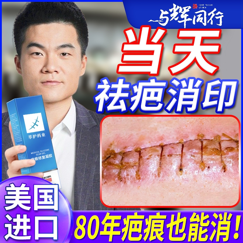 疤克祛疤膏官方旗舰店正品疤痕修复除疤膏增生凸起疙瘩芭去疤克