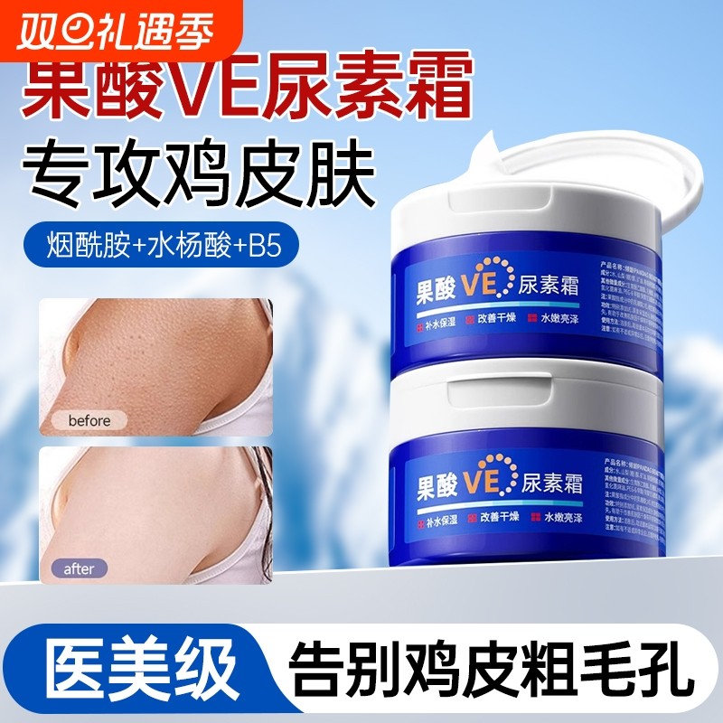 果酸ve尿素霜去鸡皮肤身体乳维生素e乳膏护手霜补水保湿滋润正品