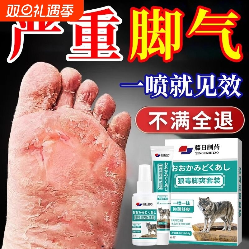 狼毒脚气喷雾止脱皮痒杀菌去真菌感染专用除臭脚出汗糜烂脚丫趾缝