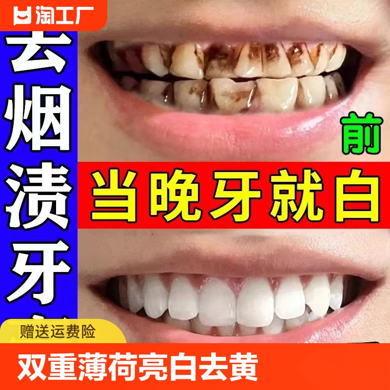 【全网爆款】去烟渍牙膏