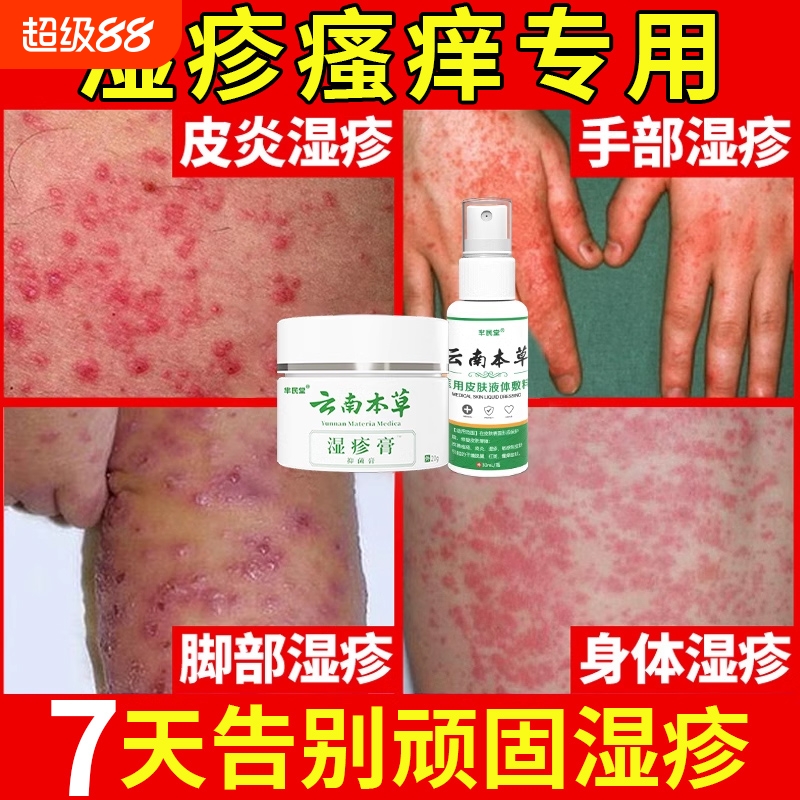 云南本草去顽固湿疹专用套装