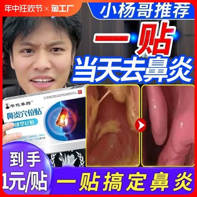 伍医生鼻炎贴儿童成人流鼻涕鼻塞专用砭官方旗舰店慢性鼻窦炎调理