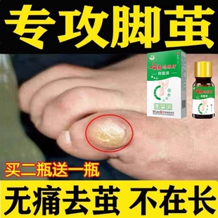 老茧清茧灵抑菌液软化剂脚底死皮脚垫神器眼鸡药水非去除肉刺杀菌