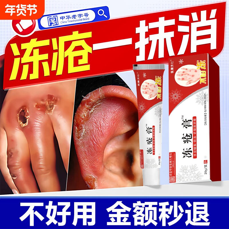 冻疮膏止痒冻伤膏正品防冻排行榜第一名官方旗舰店儿童耳朵手冻伤