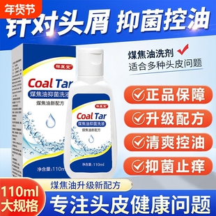 煤焦油洗剂官方旗舰店洗发正品水医用控油除螨屑去脂溢性头皮止痒