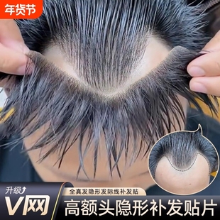 假发片男士隐形前额假刘海全真发一片式生物头皮m型发际线假发贴