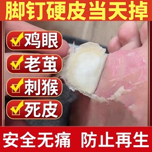 脚茧脚底老茧手茧祛去除茧立净神器死皮软化剂足手脚垫去厚茧硬皮