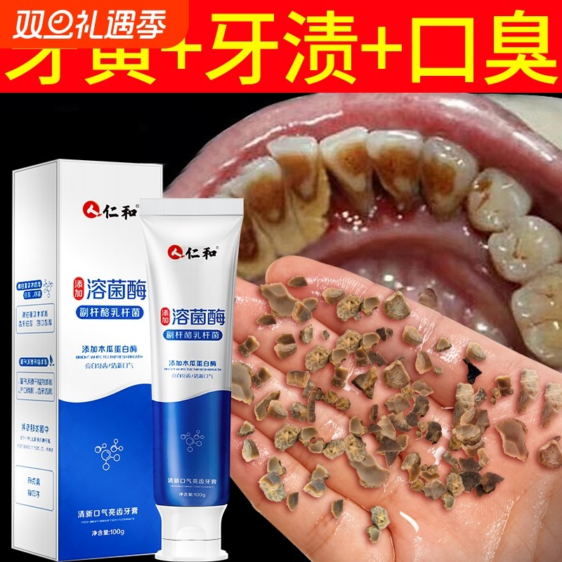 仁和牙膏美白去黄口臭渍成人洗亮白神器官方正品专用牙齿牙结石