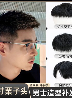 假发男士短发真发清爽短毛寸帅气栗子头男生头顶地中海男款补发片