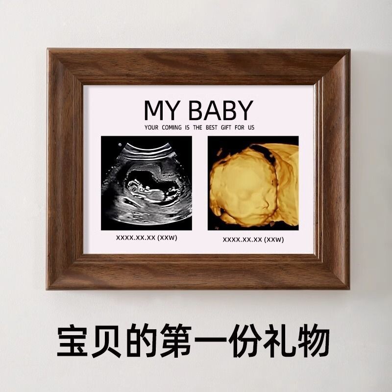 四维照片相框孕期胎儿nt B超彩超打印婴儿宝宝出生新生纪念照摆台