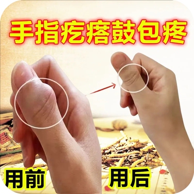 手指骨节粗大变形关节疙瘩鼓包肿大消肿疼痛专用活络