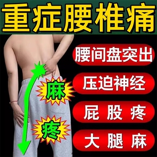 腰椎盘间突出专用药膏腰疼压迫坐骨神经痛膏药贴久坐止痛中药活血