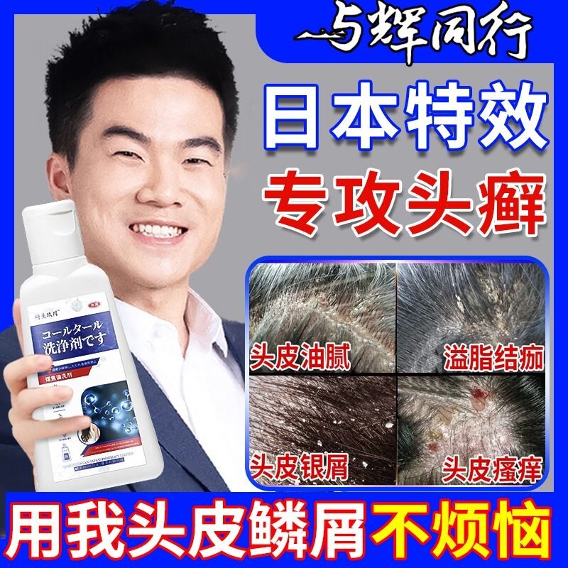 头皮癣焦油脂溢性皮炎毛囊炎真菌感染搭配治头皮屑特效头部银屑癣