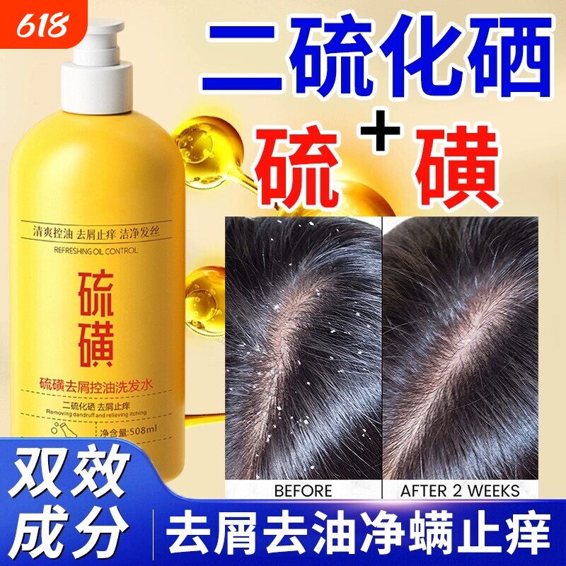 二硫化硒硫磺洗发水洗头膏毛囊去屑止痒沐浴露清洁去油头屑蓬松