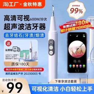 可视超声波洗牙器冲牙结石去除神器家用牙齿污垢清理洁牙仪除牙垢
