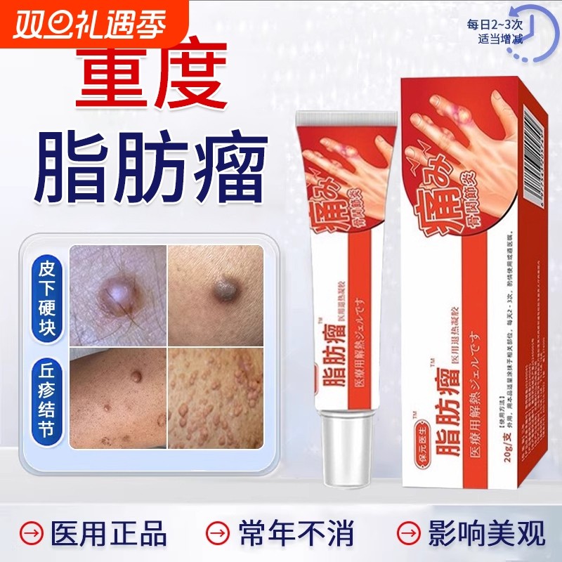 【脂肪瘤去除神器】第一名