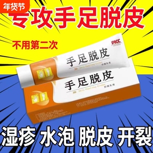 手足正品脱皮严重干裂手痒皮肤手掌干燥水泡脚丫止痒起皮膏霜防裂