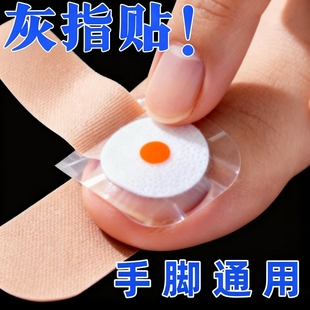 香港专研灰指防护专杀真菌指板足部美甲店灰趾美甲净萃取植物