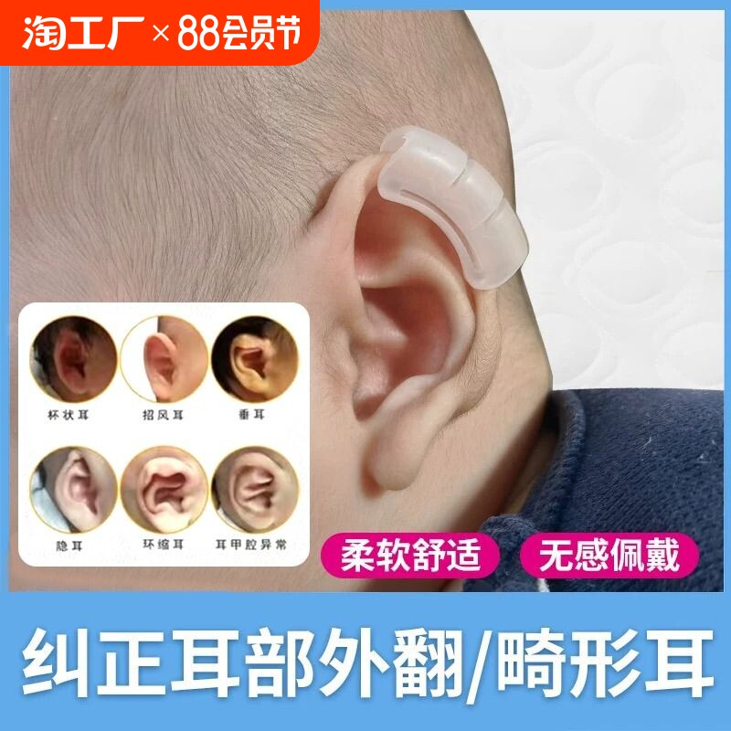 婴儿耳廓矫正器宝宝耳朵定型贴正新生儿胶带垂耳招风耳有效调整