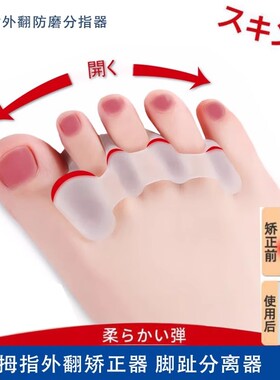 脚指套分趾器矫正指甲五指锤状指硅胶分离大母脚趾外翻弯曲纠正