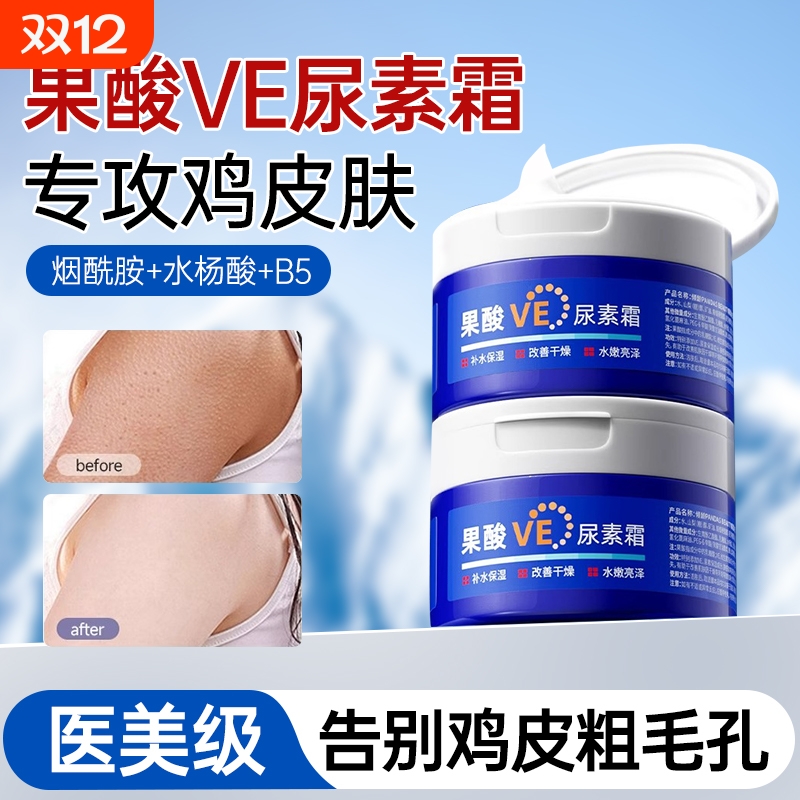 果酸ve尿素霜去鸡皮肤身体乳维生素e乳膏护手霜补水保湿滋润正品