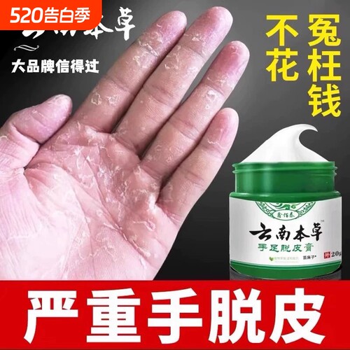 手足脱皮膏手指上真菌蜕皮干燥起皮童手掌蜕皮手心手脚掉皮褪专用