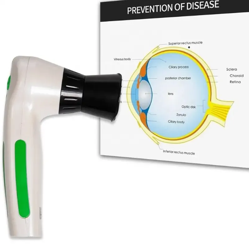 12M Pixels eye eyescope iridology Digital eyescope analyzer