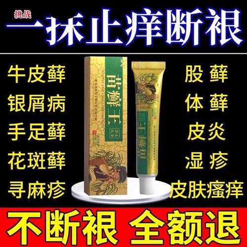 苗癣王草本乳膏断皮藓软膏外用正品杀菌皮肤湿疹止痒苗医药根膏